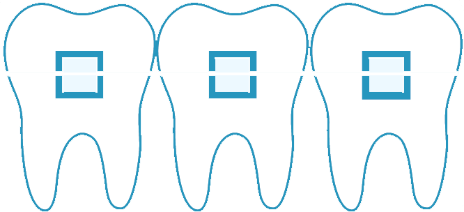 Prosthesis-Types